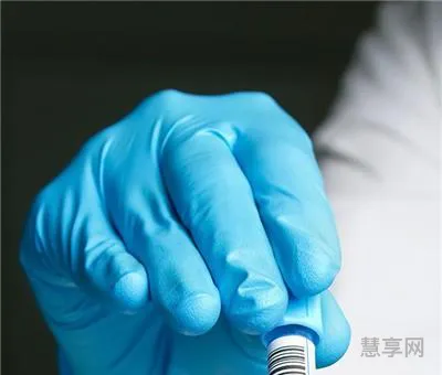 甲胎蛋白是什么意思(甲胎蛋白参考值0-7与0-20区别)