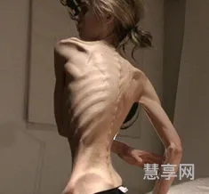骨感是什么意思(现实很骨感的解释)