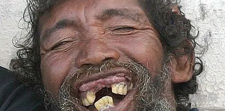 世界最丑的男人(世界第一丑男)