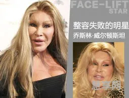 乔斯林威尔顿斯坦(乔丝琳威尔顿斯坦的原型是谁)
