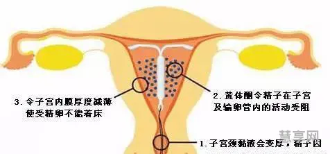 上环的最佳时间(上环的价格表2023)